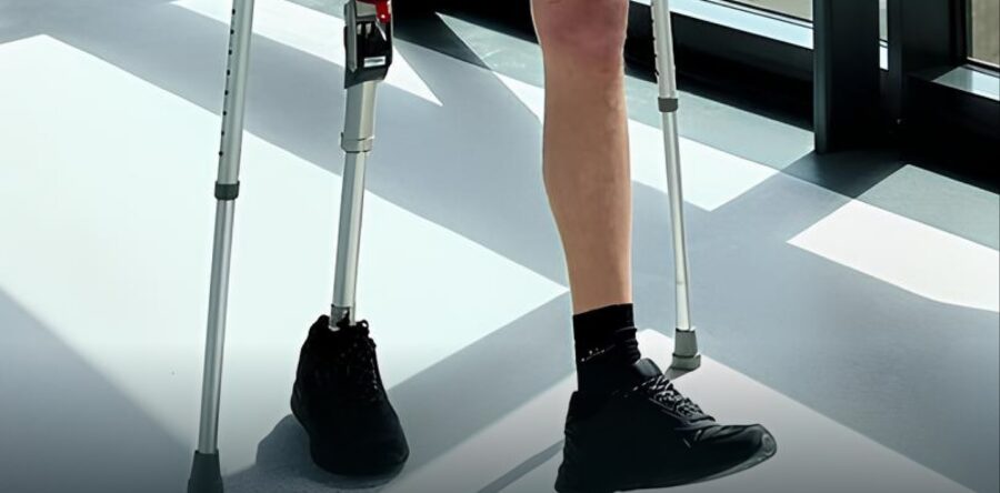 Мінсоцполітики затвердило оновлений професійний стандарт, що підвищить якість протезно-ортопедичних виробів і послуг